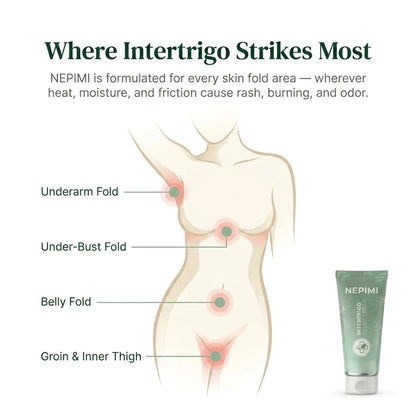 Nepimi Intertrigo Relief Cream