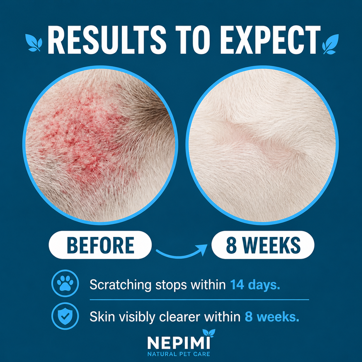 Nepimi Yeast Reset + Itch Relief Drops