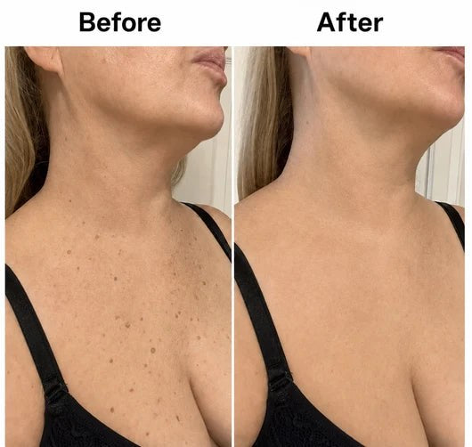 Kerava Smooth & Even Glycolic Body Stick